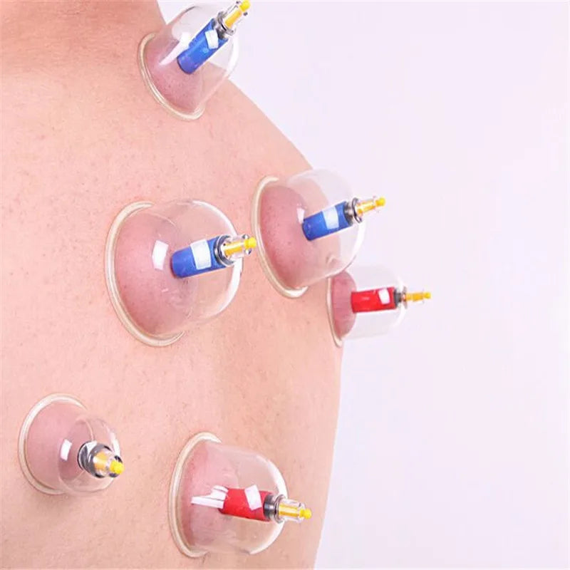 12 Cups Vacuum Cupping Massage  Acupuncture Chinese Vacuum Cupping Suction Therapy Massage Device