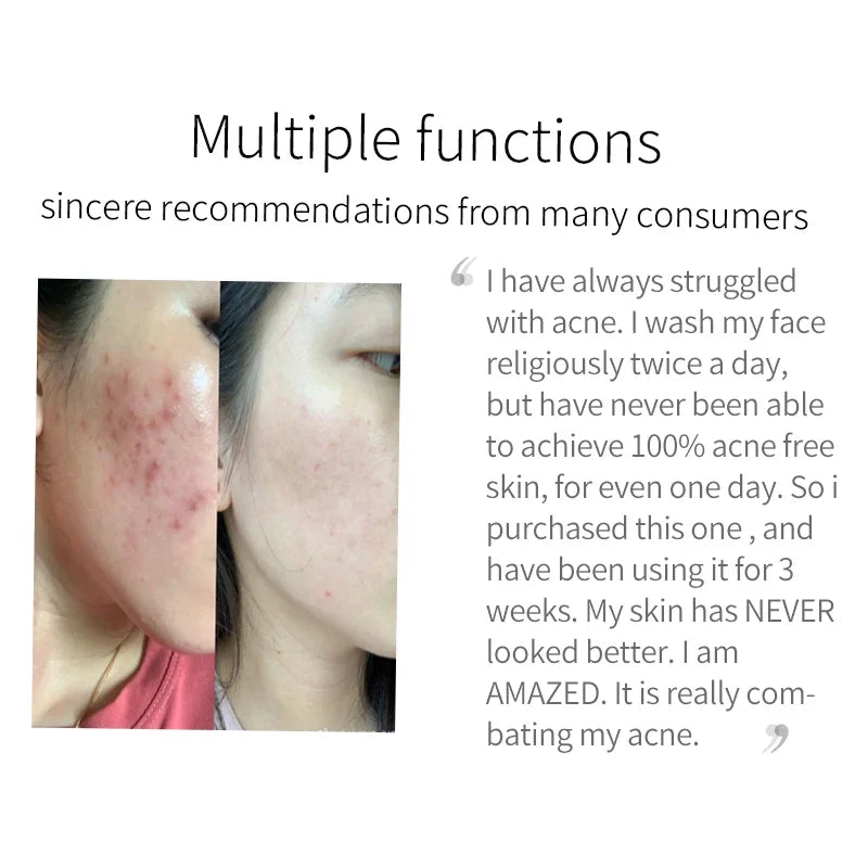 Professional Turmeric Cleanser Whitening Cream Brightening Facial Deep Cleaning Wash Foam Reduce Pockmark Acne Wrinkle Dark Spot