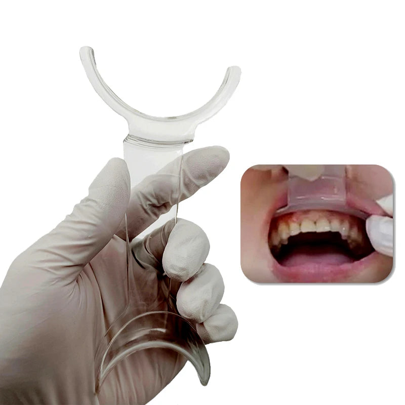 Dental Mouths Openers Lip Retractor Intraoral Cheek Upper Lower Lip Retractor Orthodontic Dentist Tools