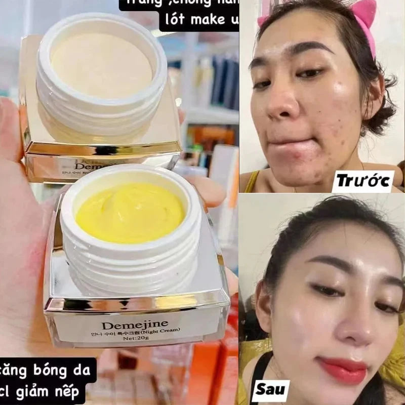 Whitening Kem, Removes Dark Spots, Acne Scars, Tightens Pores,Soft & Glowing Skin And Anti-Aging  ﻿