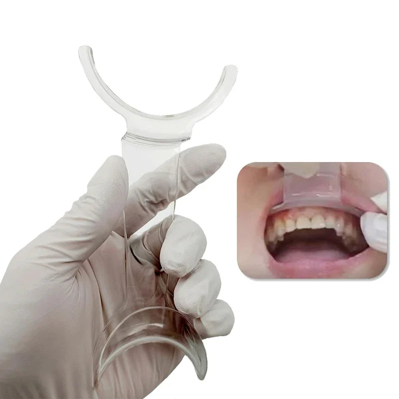 Dental Mouth Expand Lip Retractor Intraoral Cheek Upper Lower Lip Retractor Dental Mouths Openers Orthodontic Dentist Tools