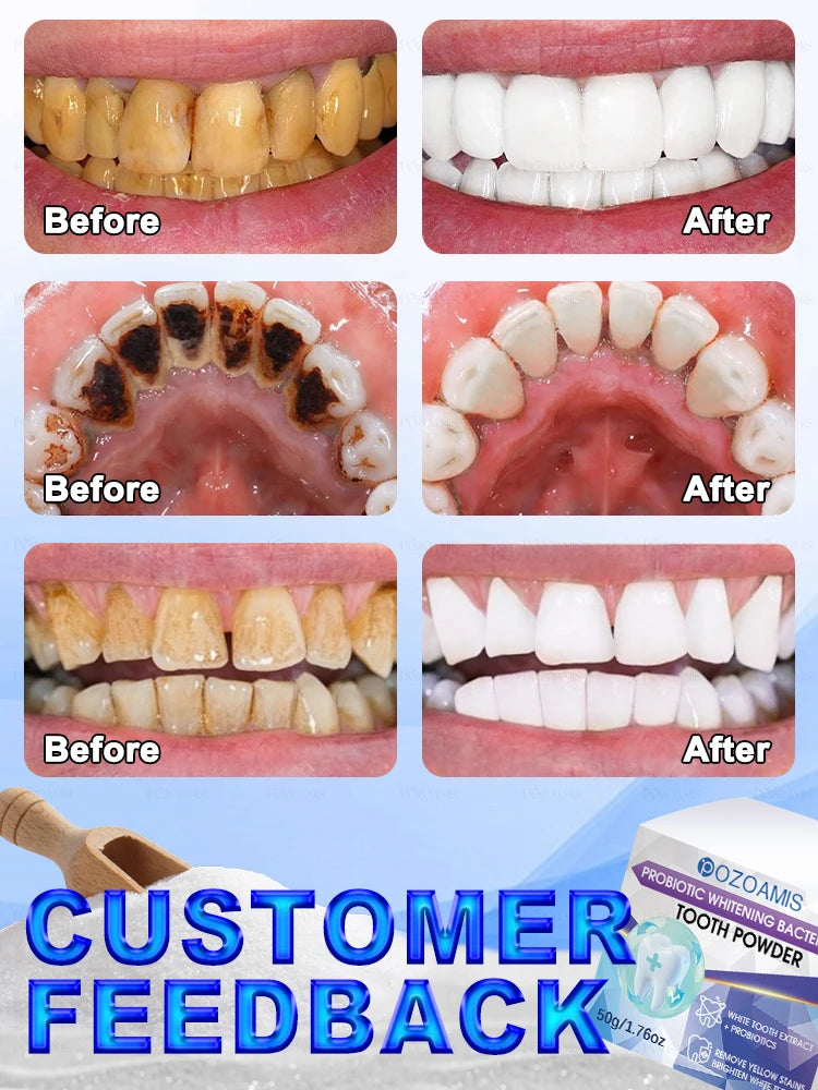 2025 new black technology for whitening teeth effectively cleans oral problems