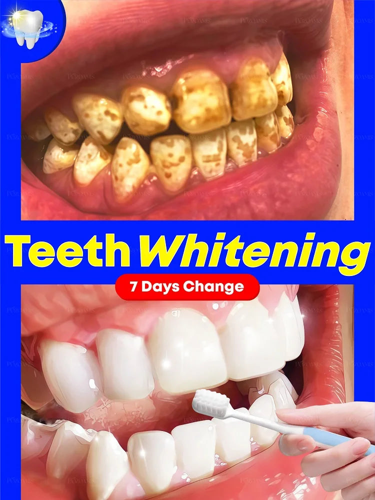 2025 new black technology for whitening teeth effectively cleans oral problems
