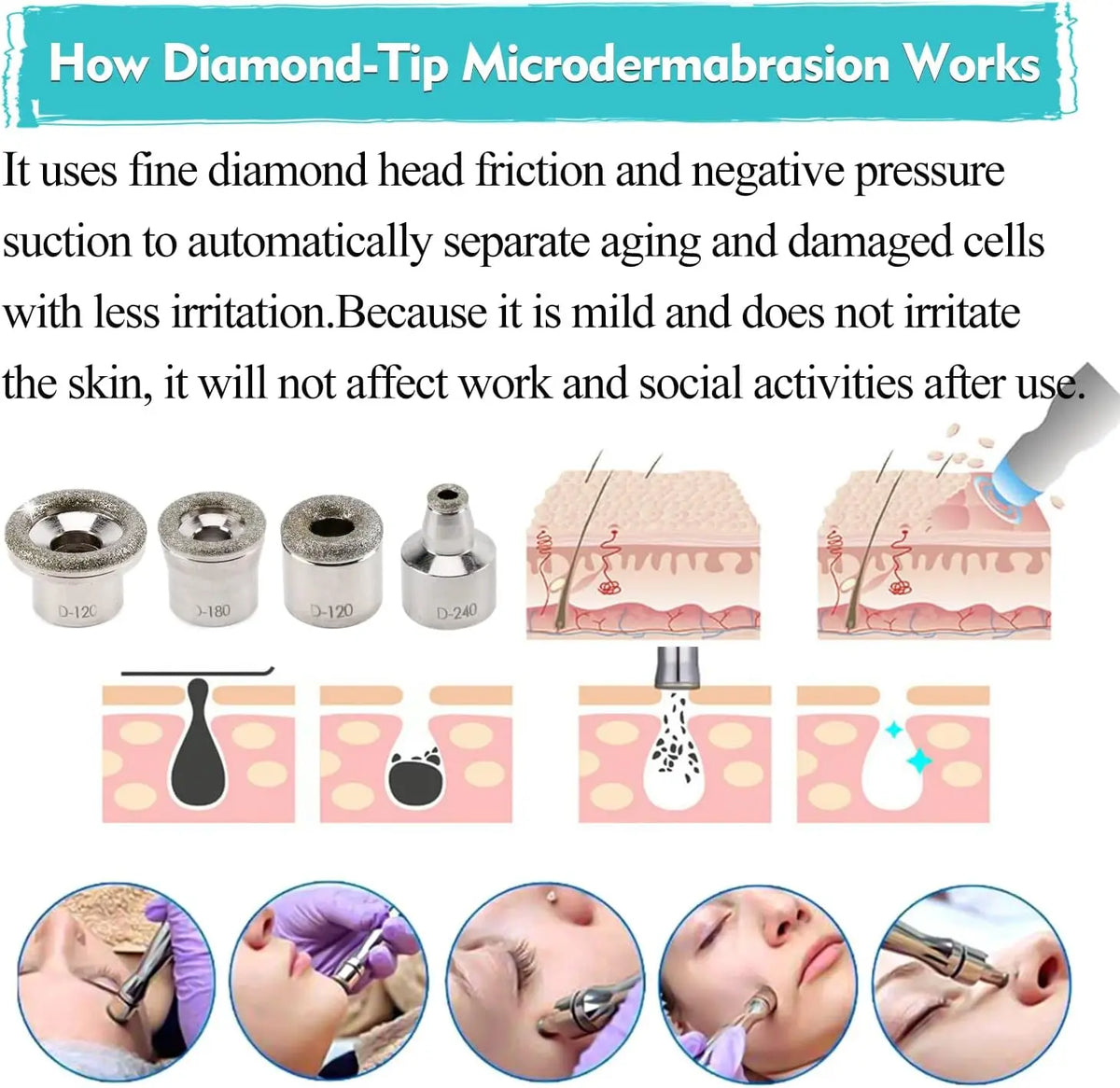 Diamond Microdermabrasion Machine, 65-68cmHg Suction Power Professional Dermabrasion, Home Use Facial Skin Care Equipment