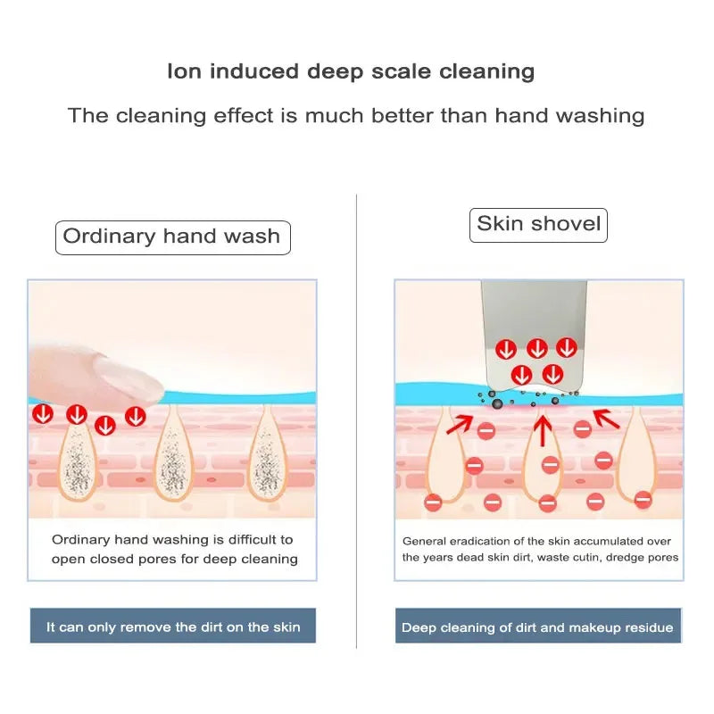 Ultrasonic skin scrubber facial ion cleaning vibrating spatula to blackhead acne exfoliating facial lifting machine