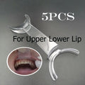 Dental Mouth Expand Lip Retractor Intraoral Cheek Upper Lower Lip Retractor Dental Mouths Openers Orthodontic Dentist Tools