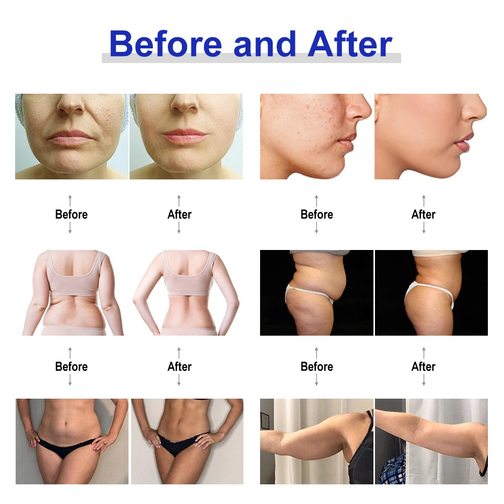 New 2 In 1 Radio Frequency Machine Face Lifting Body Slimming RF Lift Skin Care Rejuvenation Anti Wrinkle Beauty Facial Machine