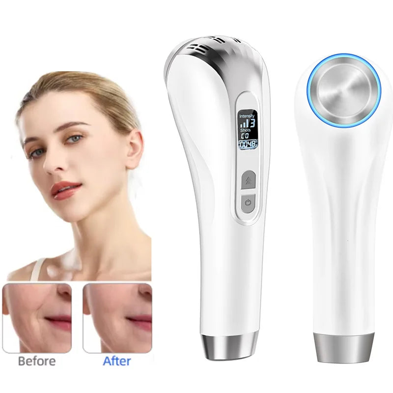 3-10Mhz Ultrasonic Facial Radio Frequency Vibration Machine Skin Tightening Lifting Wrinkle Removal Massager Beauty Face Care