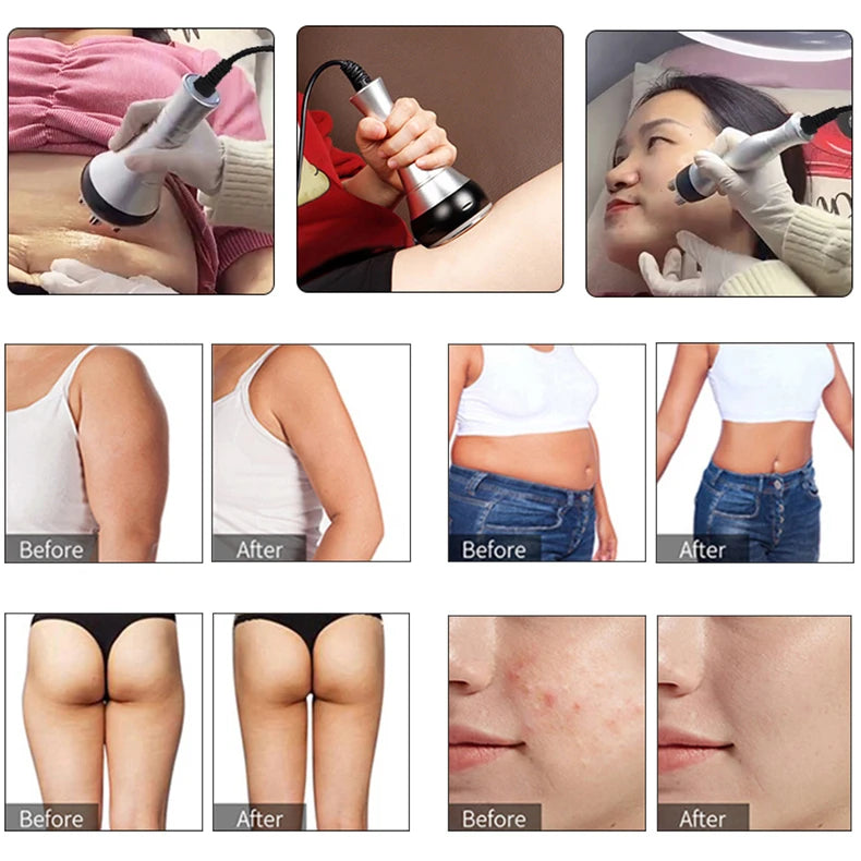 Cavitation Slimming Machine for Massage Portable Beauty Equipment for Women Skin Tightening Lifting And Wrinkle Reduction
